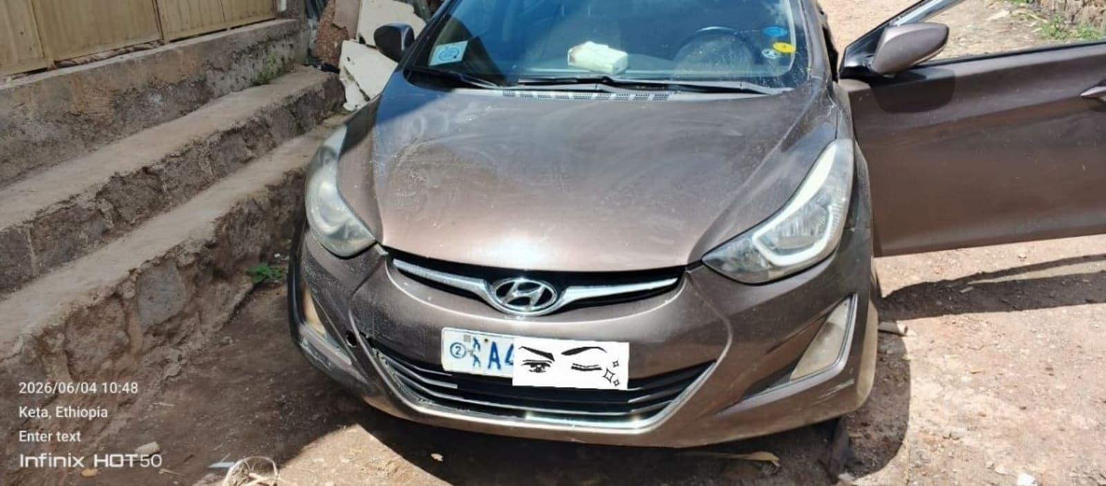 2014 Hyundai Elentra — photo 5