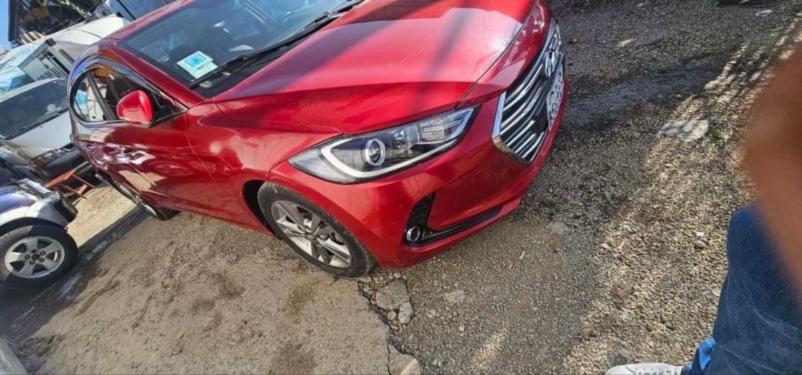2017 Hyundai Avante — photo 3